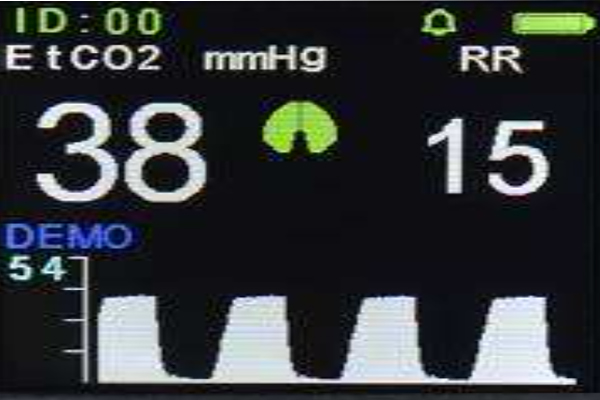 EtCo2 Supplies product image 1 of 3