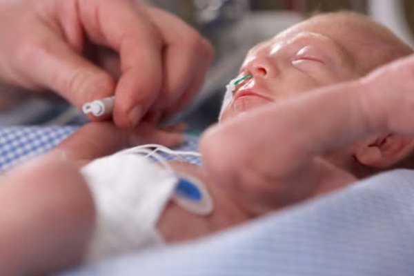 Neonate Skin Probes product image 1 of 9